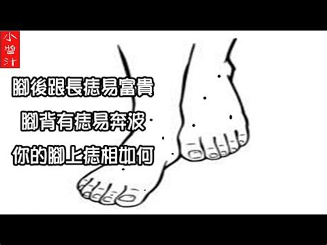 腳邊有痣|腳趾有痣代表什麼圖解